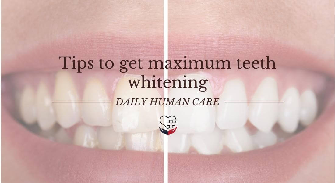 Tips to get maximum teeth whitening